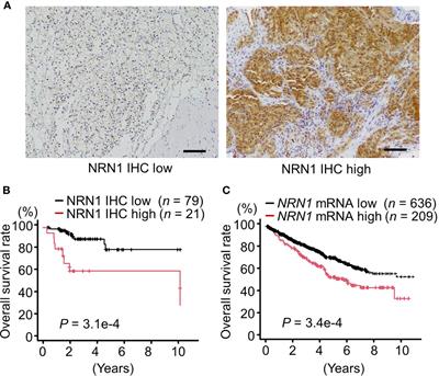 Clinicopathological and Preclinical Patient-Derived Model Studies Define High Expression of NRN1 as a Diagnostic and Therapeutic Target for Clear Cell Renal Cell Carcinoma